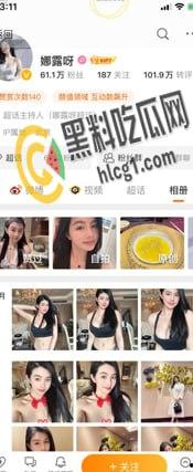 抖音 快手 微博 三栖网红「娜露呀」真正土豪福利流出 微密圈弱爆了！  第1张