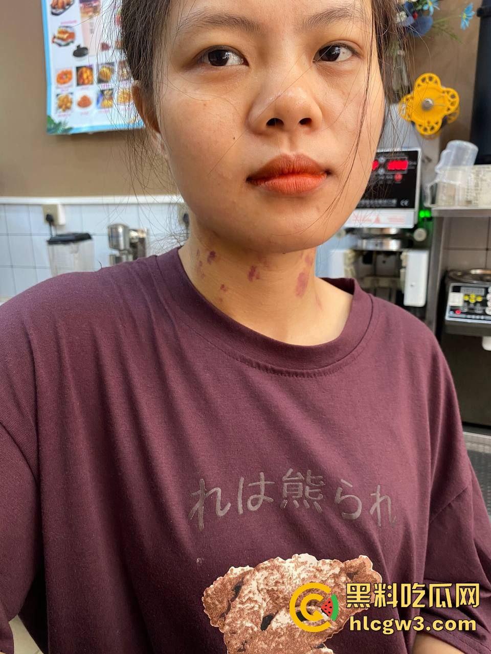 河南骚货【赵露露】的母狗身份被男友实锤 ，裸照生活照全曝光，脖子草莓遍布像得了病一样  第10张