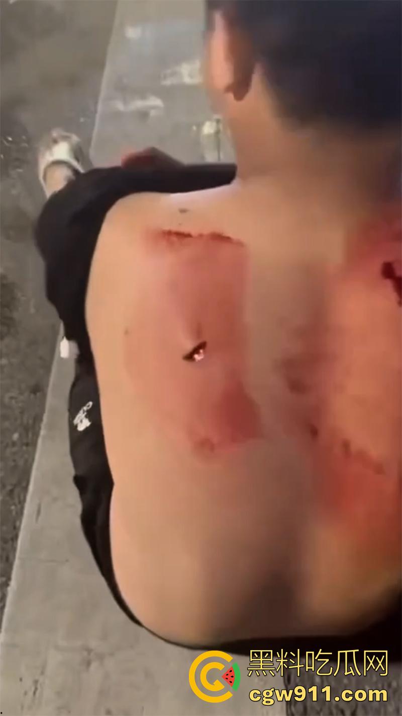 江西赣州第七中学，精神小伙小妹发生口角，叫人斗殴持砍刀砍人，警方和120急救人员陆续赶到，现场多人受伤。  第4张