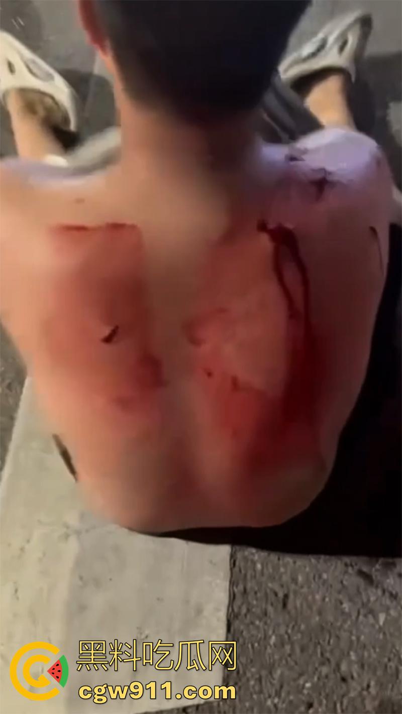 江西赣州第七中学，精神小伙小妹发生口角，叫人斗殴持砍刀砍人，警方和120急救人员陆续赶到，现场多人受伤。  第5张