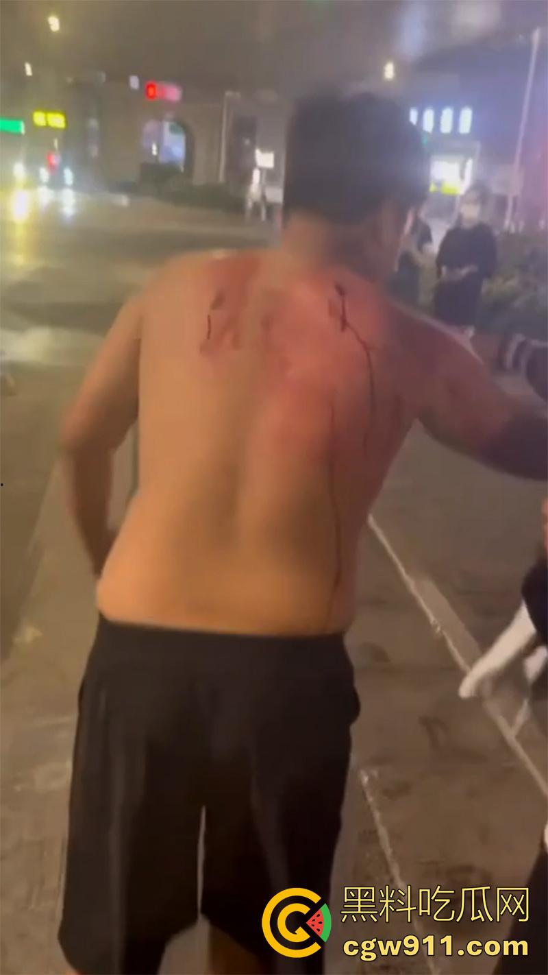 江西赣州第七中学，精神小伙小妹发生口角，叫人斗殴持砍刀砍人，警方和120急救人员陆续赶到，现场多人受伤。  第6张