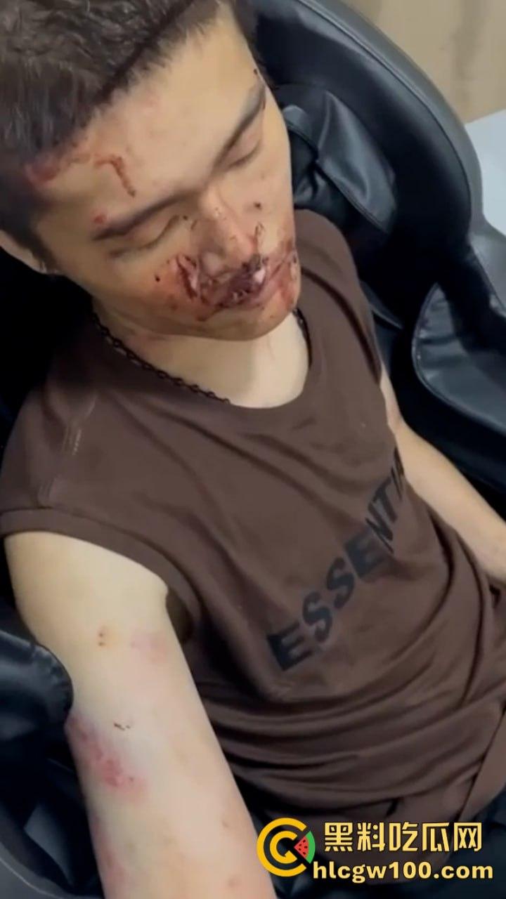 电棍烤肉天天有 鞭打枪击家常饭 东南亚园区猪仔真实生活实况流出 第1张 电棍烤肉天天有 鞭打枪击家常饭 东南亚园区猪仔真实生活实况流出 第1张