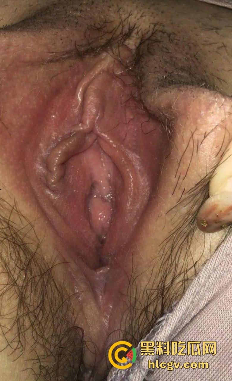 南充美女【李婉钰】被前男友曝光私密视频!黑丝长腿玩兴跳,长棍插穴骚气爆棚! 第10张 南充美女【李婉钰】被前男友曝光私密视频!黑丝长腿玩兴跳,长棍插穴骚气爆棚! 第10张