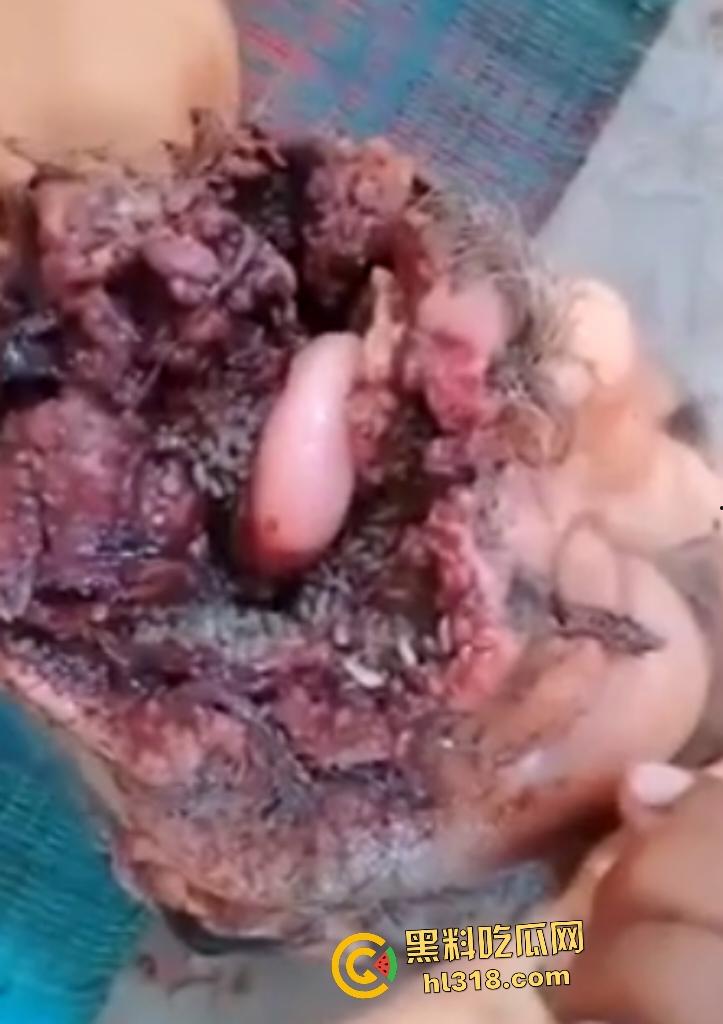 埃及老人惨遭机器重击,脸烂成浆五官全毁,只能阿巴阿巴发声音,不能说话,估计过几天就要长蛆了! 第3张 埃及老人惨遭机器重击,脸烂成浆五官全毁,只能阿巴阿巴发声音,不能说话,估计过几天就要长蛆了! 第3张