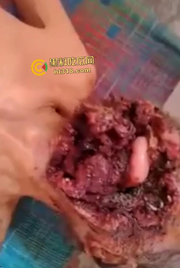 埃及老人惨遭机器重击,脸烂成浆五官全毁,只能阿巴阿巴发声音,不能说话,估计过几天就要长蛆了! 第4张 埃及老人惨遭机器重击,脸烂成浆五官全毁,只能阿巴阿巴发声音,不能说话,估计过几天就要长蛆了! 第4张