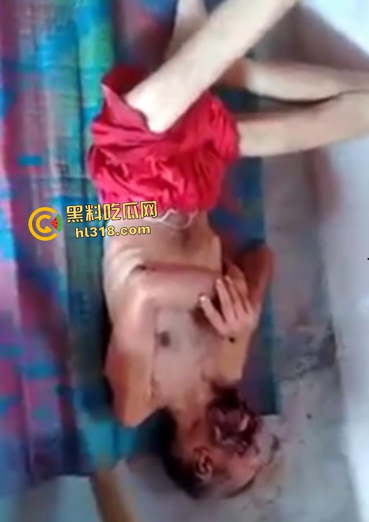 埃及老人惨遭机器重击,脸烂成浆五官全毁,只能阿巴阿巴发声音,不能说话,估计过几天就要长蛆了! 第6张 埃及老人惨遭机器重击,脸烂成浆五官全毁,只能阿巴阿巴发声音,不能说话,估计过几天就要长蛆了! 第6张