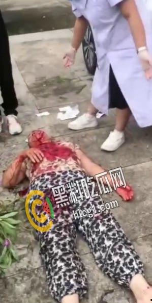 畜生行为！浙江海宁市周王庙镇 畜生孙子为了一个西瓜爆打奶奶 把奶奶打到浑身是血 倒地不起  第5张