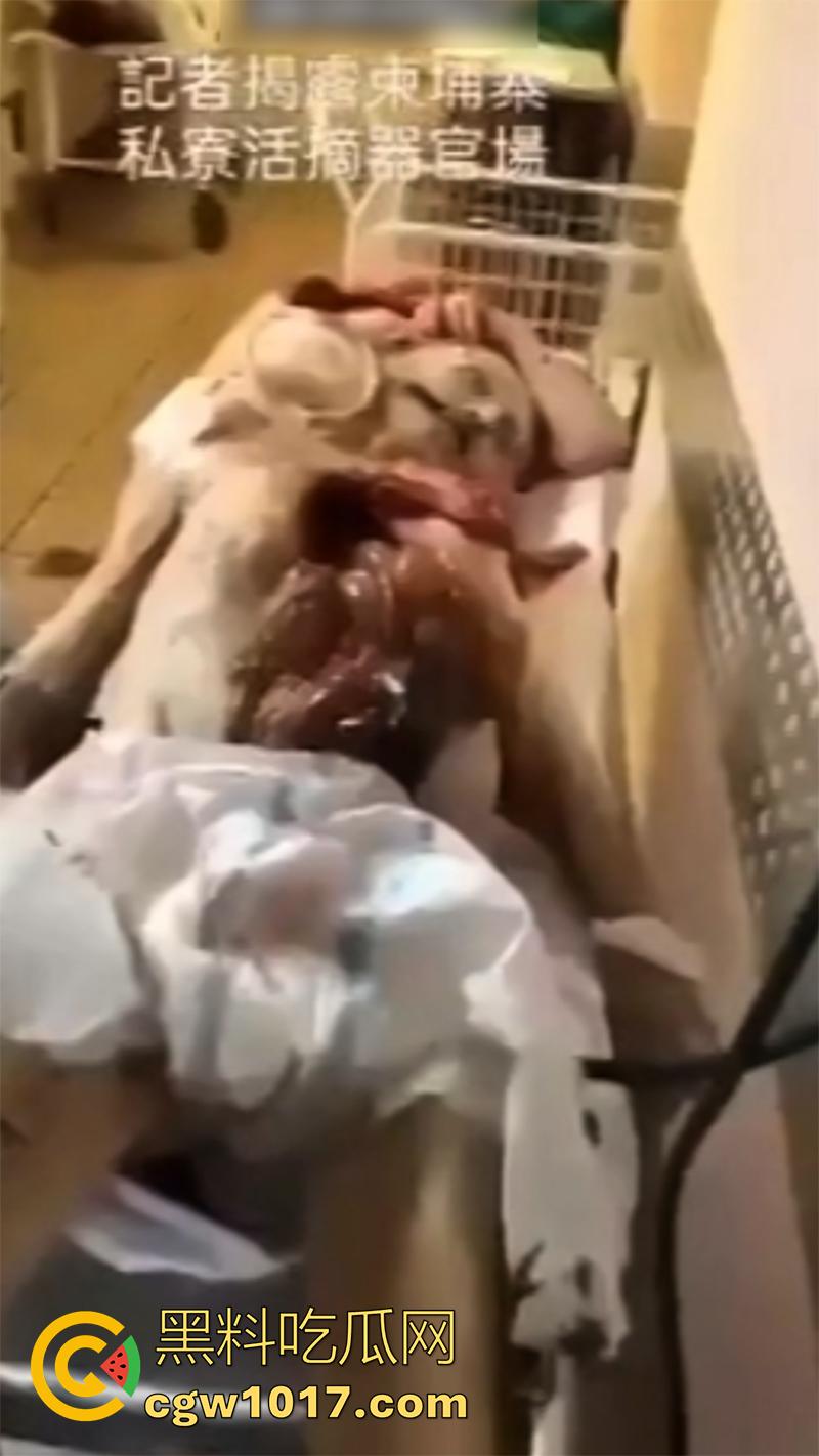 柬埔寨器官交易场实拍，猪仔狗推的最终贩卖地，难怪这里每个人都值钱，只要血型匹配有买主，立刻就会被拉走！  第2张