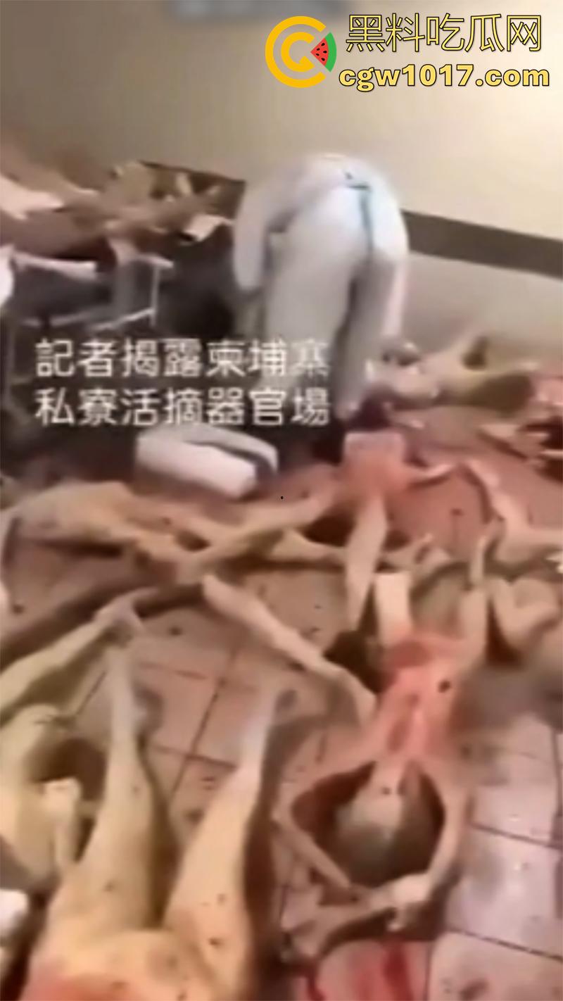 柬埔寨器官交易场实拍，猪仔狗推的最终贩卖地，难怪这里每个人都值钱，只要血型匹配有买主，立刻就会被拉走！  第7张