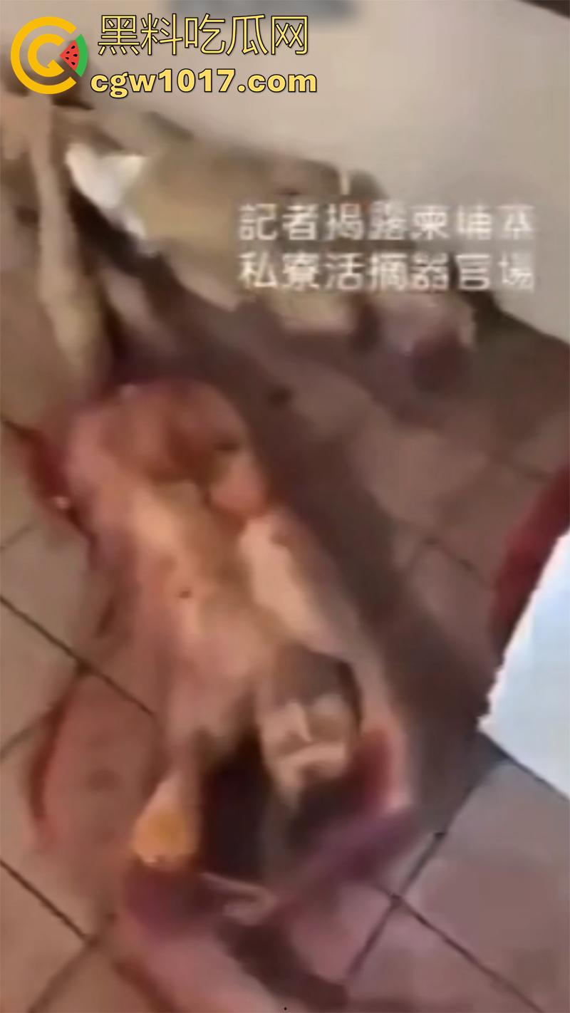 柬埔寨器官交易场实拍，猪仔狗推的最终贩卖地，难怪这里每个人都值钱，只要血型匹配有买主，立刻就会被拉走！  第8张