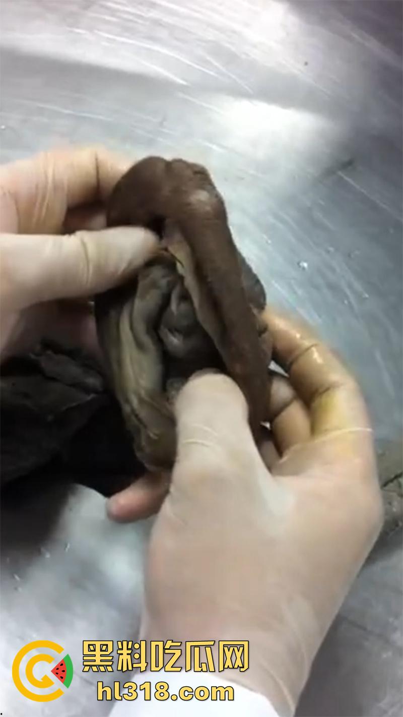 真实西藏密宗法器“肉莲花”，少女被108罗汉轮奸后，五毒侵蚀九蒸九炼，活体切割才可肉莲大成！  第2张