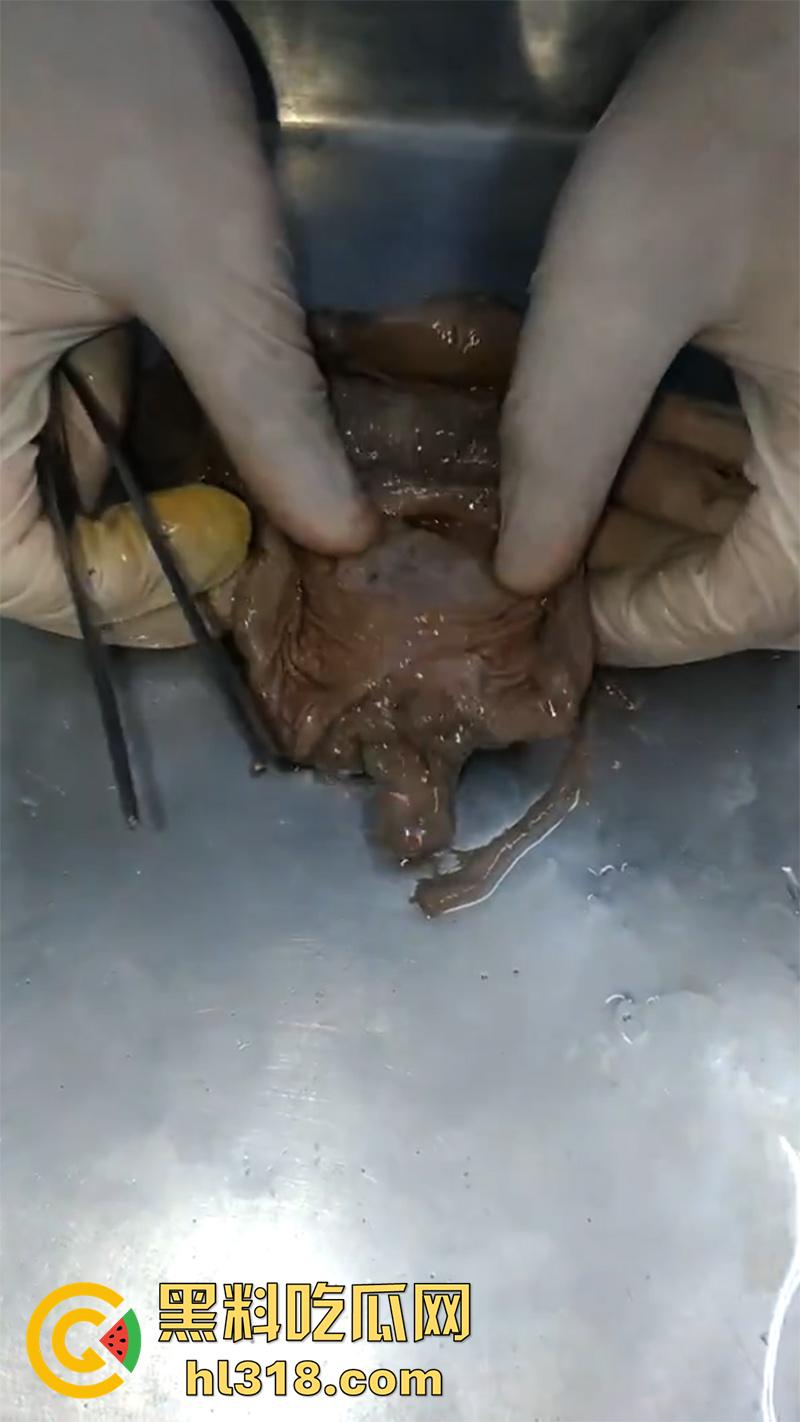 真实西藏密宗法器“肉莲花”，少女被108罗汉轮奸后，五毒侵蚀九蒸九炼，活体切割才可肉莲大成！  第3张