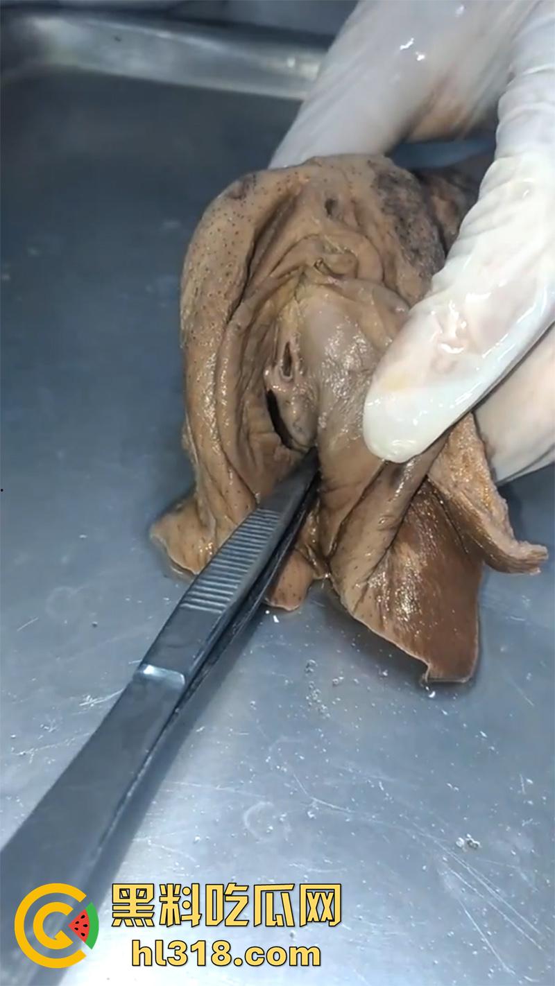 真实西藏密宗法器“肉莲花”，少女被108罗汉轮奸后，五毒侵蚀九蒸九炼，活体切割才可肉莲大成！  第5张