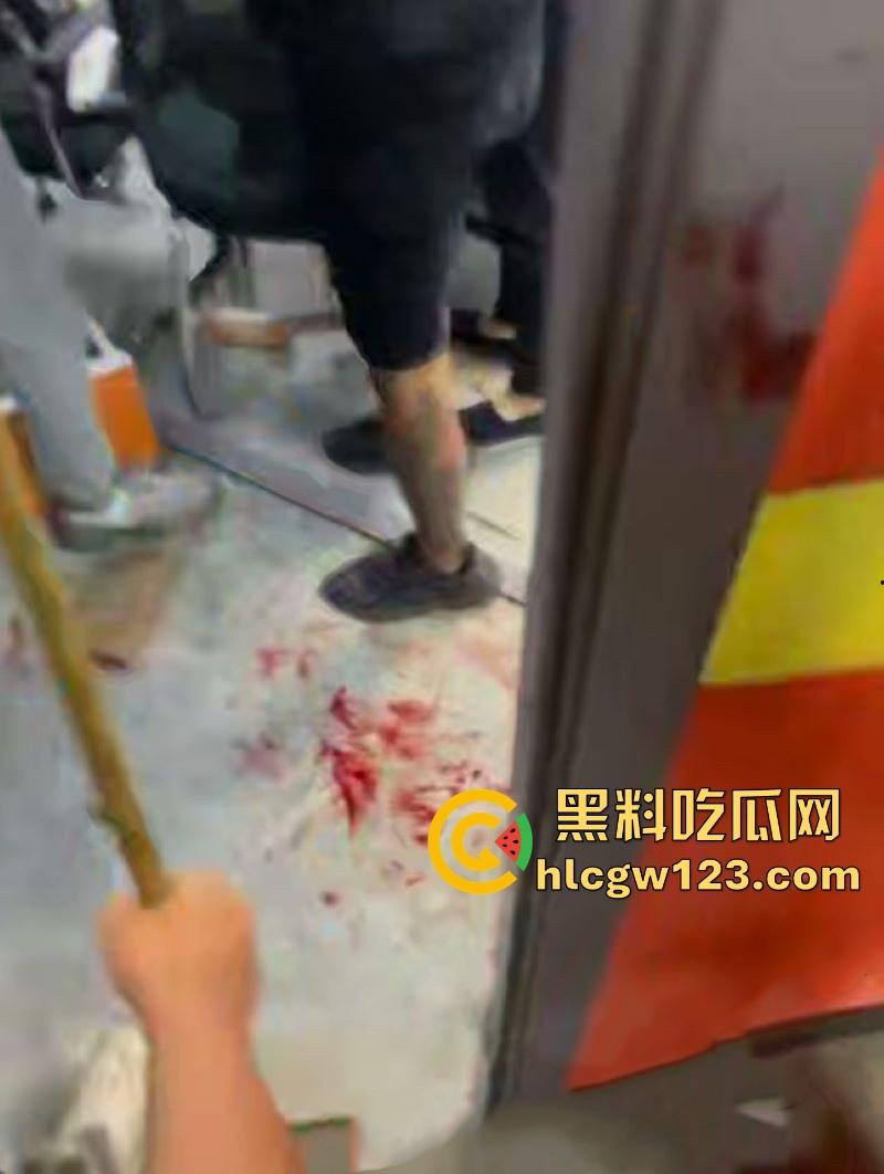 精神小伙台球厅打斗事件!暴怒持刀砍人 手掌惨遭斩成两半 现场血淋淋一片 场面极其血腥胆小勿入! 第4张 精神小伙台球厅打斗事件!暴怒持刀砍人 手掌惨遭斩成两半 现场血淋淋一片 场面极其血腥胆小勿入! 第4张