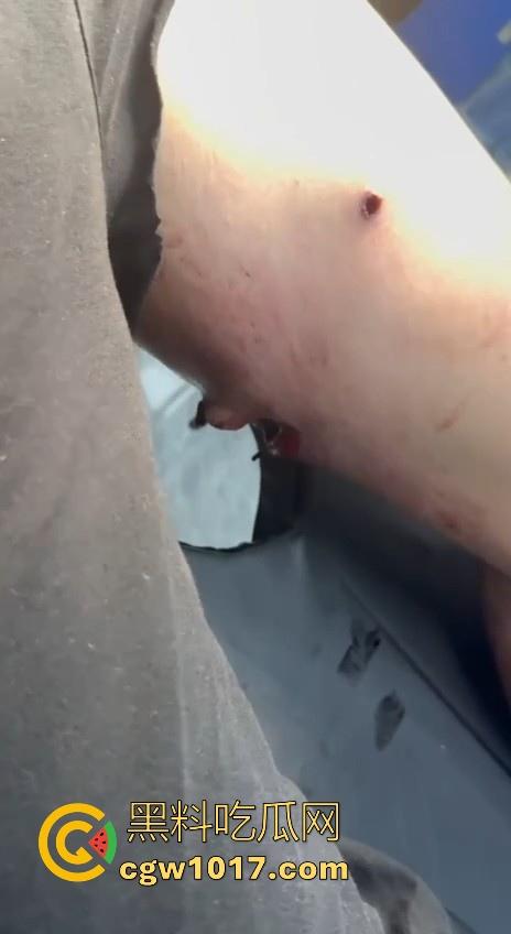 妙瓦底顺达园区缅甸KUN武装屠杀中国人!抢劫、轮奸、枪杀地盘之争,诈骗人员沦落为牺牲品,这时候你是中国人啦! 第10张 妙瓦底顺达园区缅甸KUN武装屠杀中国人!抢劫、轮奸、枪杀地盘之争,诈骗人员沦落为牺牲品,这时候你是中国人啦! 第10张