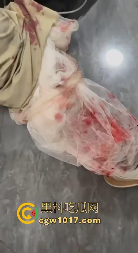 妙瓦底顺达园区缅甸KUN武装屠杀中国人!抢劫、轮奸、枪杀地盘之争,诈骗人员沦落为牺牲品,这时候你是中国人啦! 第13张 妙瓦底顺达园区缅甸KUN武装屠杀中国人!抢劫、轮奸、枪杀地盘之争,诈骗人员沦落为牺牲品,这时候你是中国人啦! 第13张