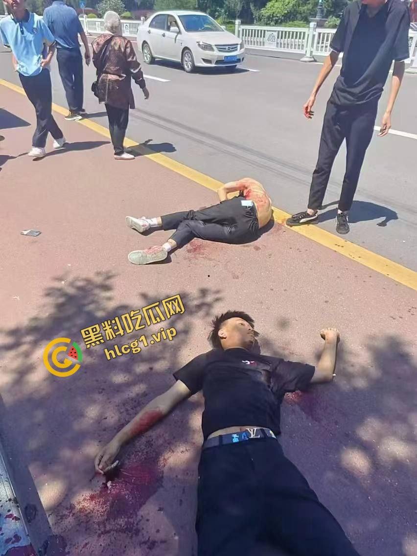 甘肃平凉捅人事件!5个精神小伙围堵1个高三学生 利用管制刀具反杀1人!致2人重伤 3人逃跑! 第8张 甘肃平凉捅人事件!5个精神小伙围堵1个高三学生 利用管制刀具反杀1人!致2人重伤 3人逃跑! 第8张