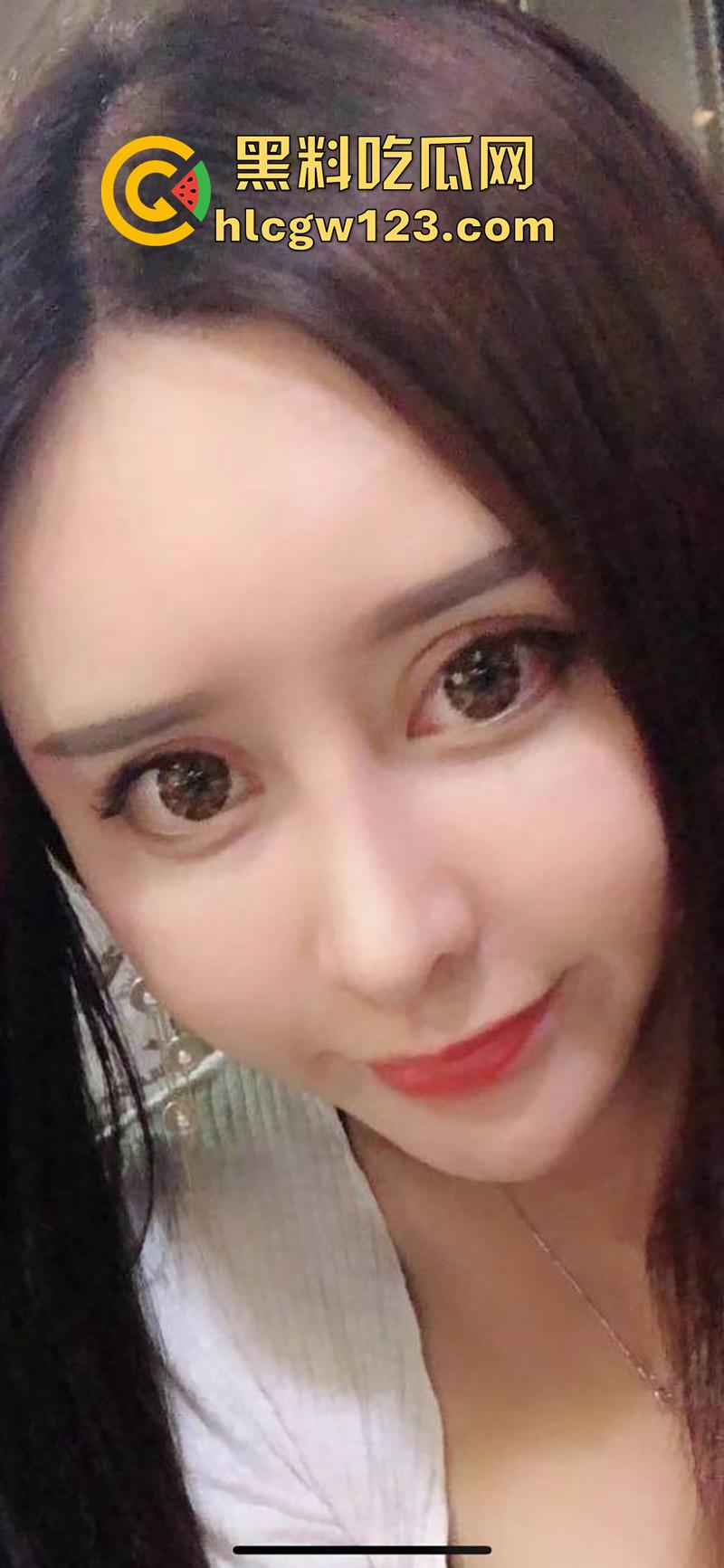 成都整容女生化母体，颜值高身材高挑性感，经常卖逼约炮染上梅毒，到处约炮感染年轻帅哥！  第6张