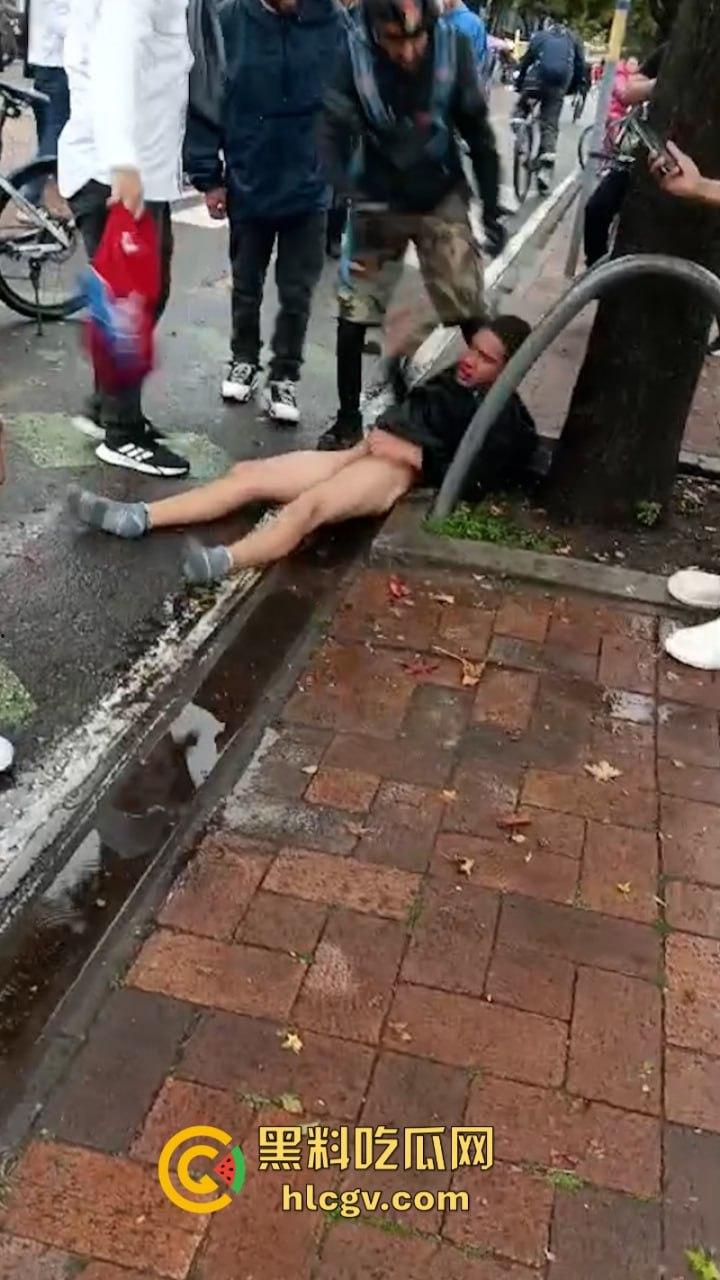 蛋痛!加州小偷扒钱包被抓现行 惨遭正义群众群体攻击 脱裤捏蛋:叫成这样是爆了吗? 第4张 蛋痛!加州小偷扒钱包被抓现行 惨遭正义群众群体攻击 脱裤捏蛋:叫成这样是爆了吗? 第4张