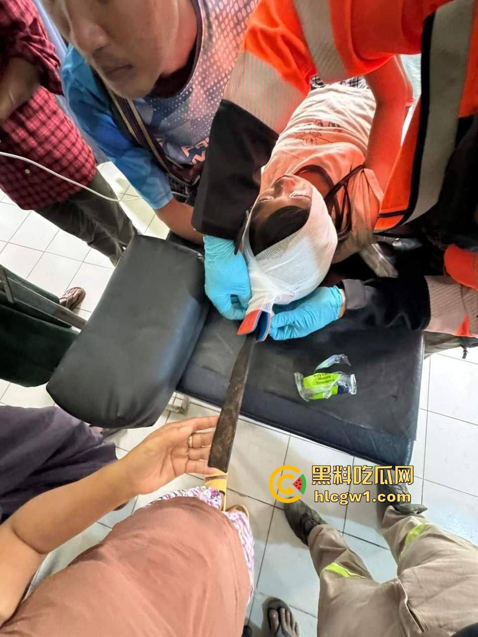 妙瓦底一女孩头部被刀插入！竹片墙掉刀酿惨剧，紧急送往泰国湄索医院！  第7张