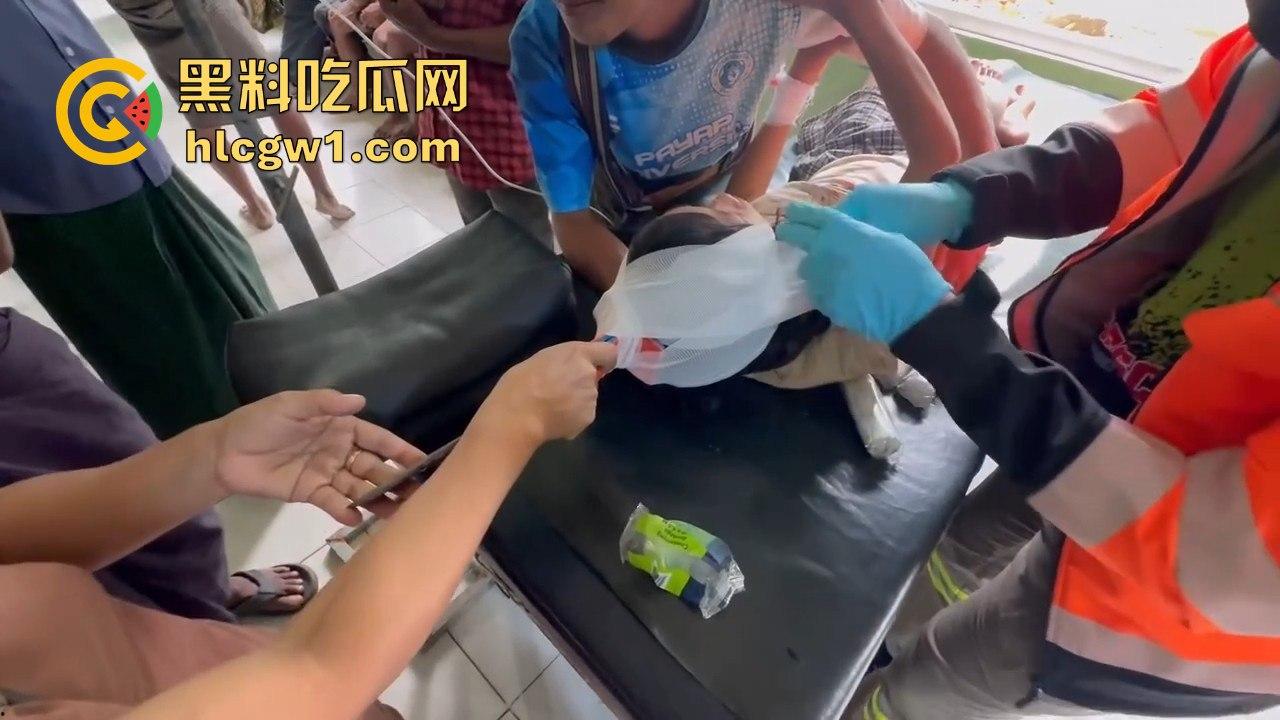 妙瓦底一女孩头部被刀插入！竹片墙掉刀酿惨剧，紧急送往泰国湄索医院！  第10张