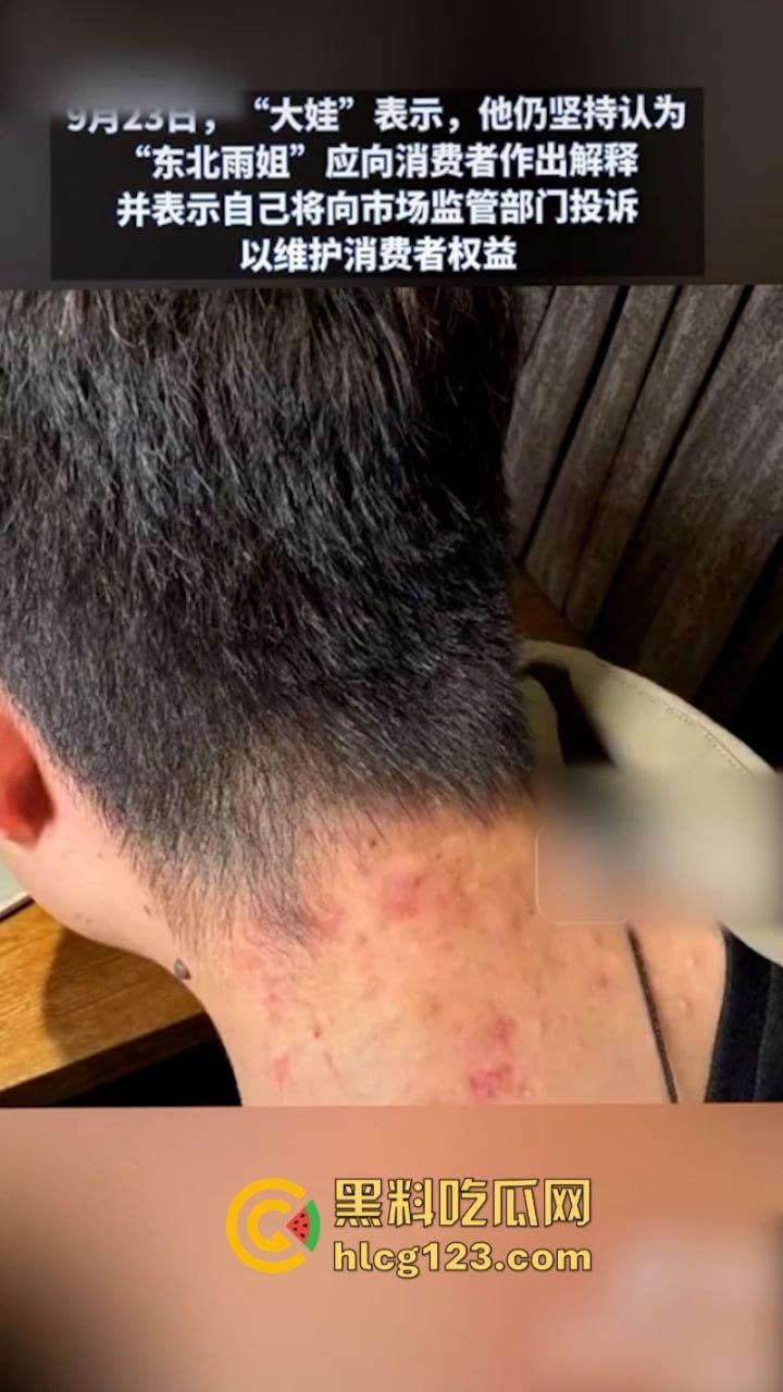 一分钟收入100w？抖音千万网红 【东北雨姐】售卖假红薯粉粉涉嫌虚假宣被打假！  第2张