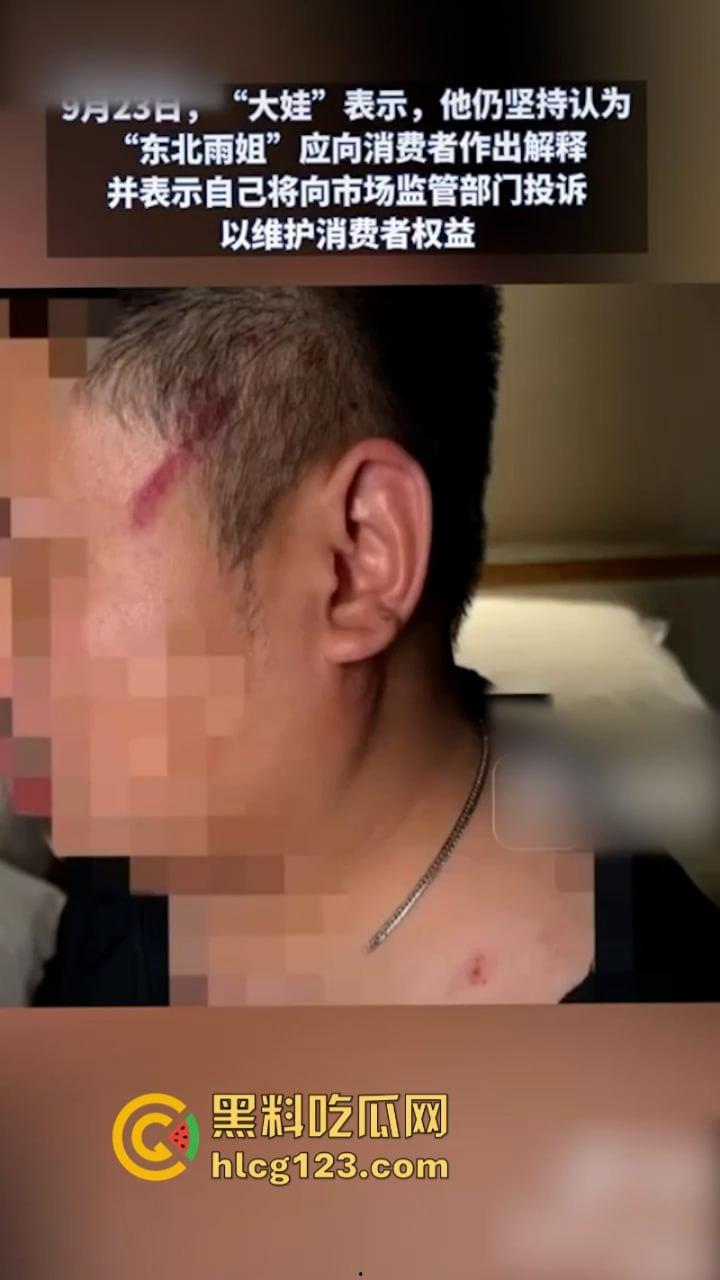 一分钟收入100w？抖音千万网红 【东北雨姐】售卖假红薯粉粉涉嫌虚假宣被打假！  第16张