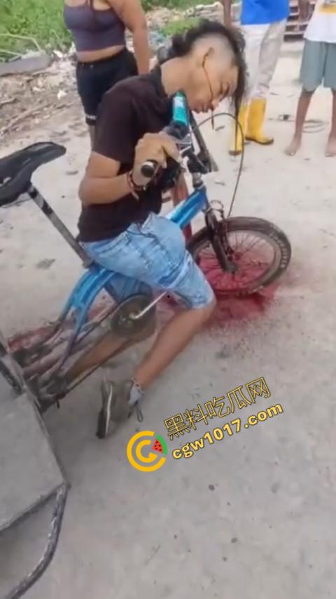 恐怖视频曝光!小伙头颅神秘贯穿,三轮车穿颅血染街头血腥现场骇人惊魂,神秘死亡惊掉下巴! 第1张 恐怖视频曝光!小伙头颅神秘贯穿,三轮车穿颅血染街头血腥现场骇人惊魂,神秘死亡惊掉下巴! 第1张