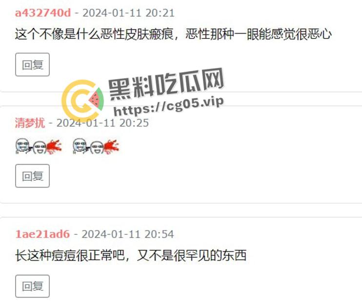 鸡圈顶流【阿朱】疑似患有梅毒?被细心网友拿着放大镜看深究美图,难道是上个月参加淫趴所得? 第10张 鸡圈顶流【阿朱】疑似患有梅毒?被细心网友拿着放大镜看深究美图,难道是上个月参加淫趴所得? 第10张