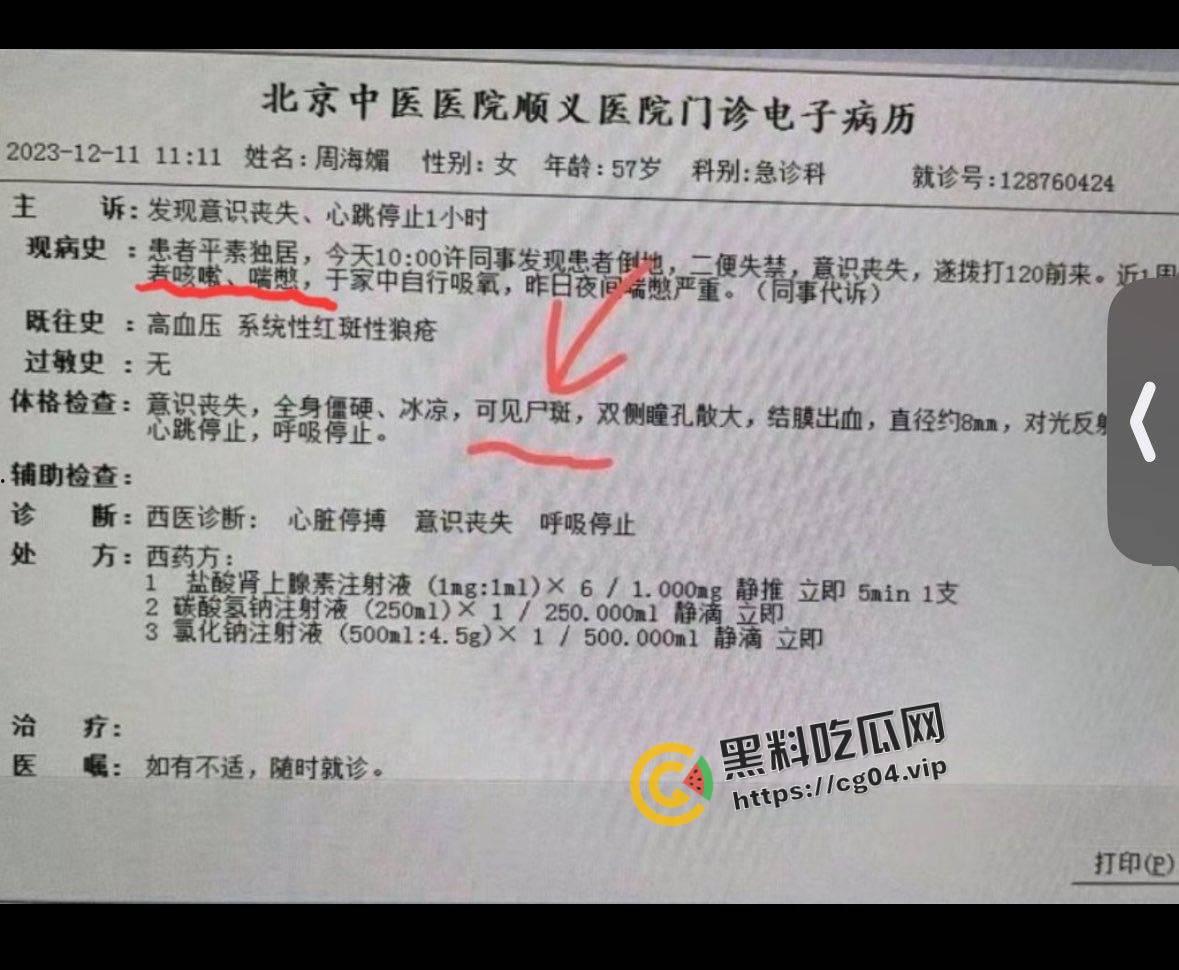 最新！周海媚死亡病例流出 去世前身上已有尸斑  流出的医生将被严惩 第1张