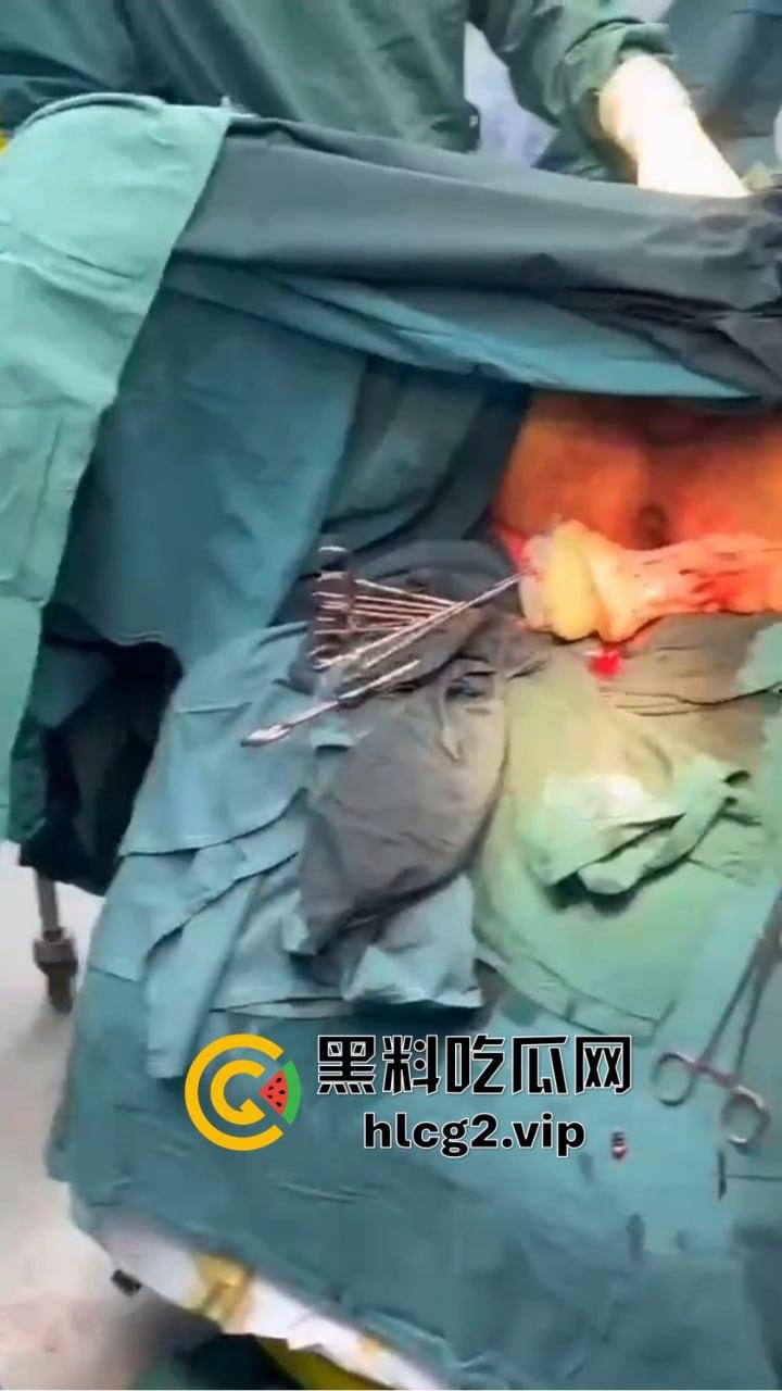 重口慎点！男子硬塞20厘米假体进体内，女子螃蟹夹逼狠整，为了流量太拼了！  第7张