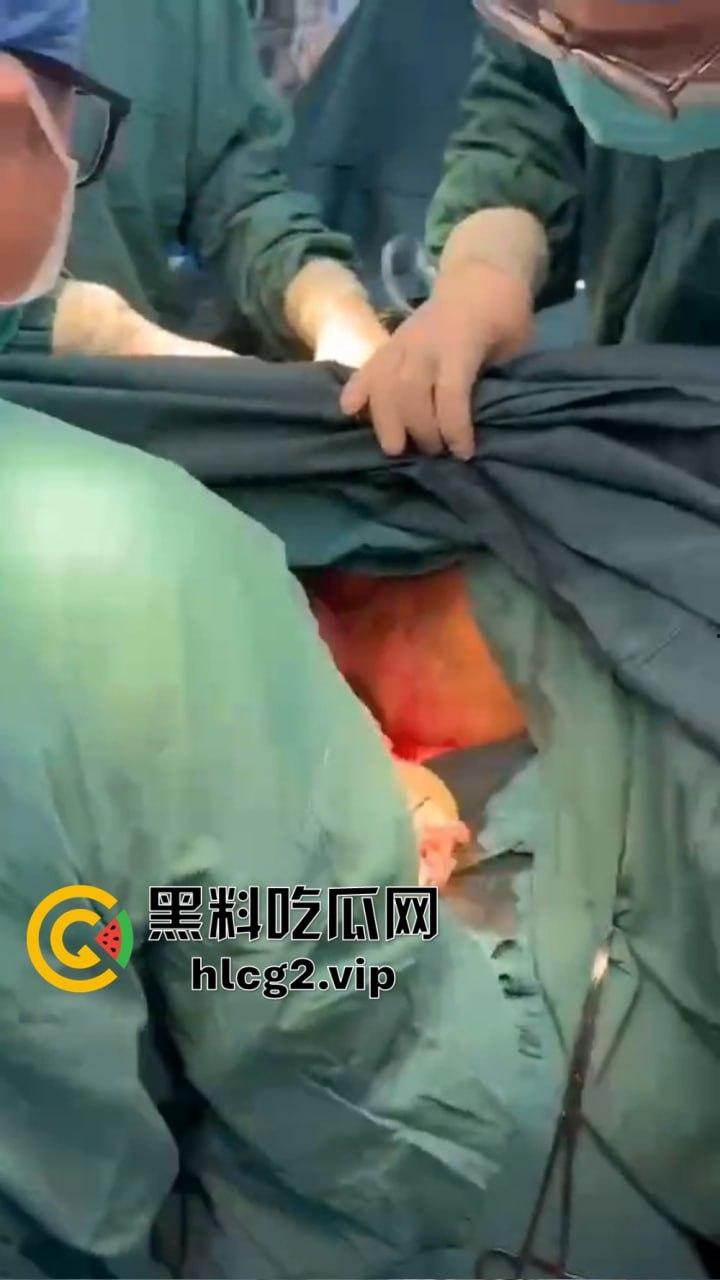 重口慎点！男子硬塞20厘米假体进体内，女子螃蟹夹逼狠整，为了流量太拼了！  第9张