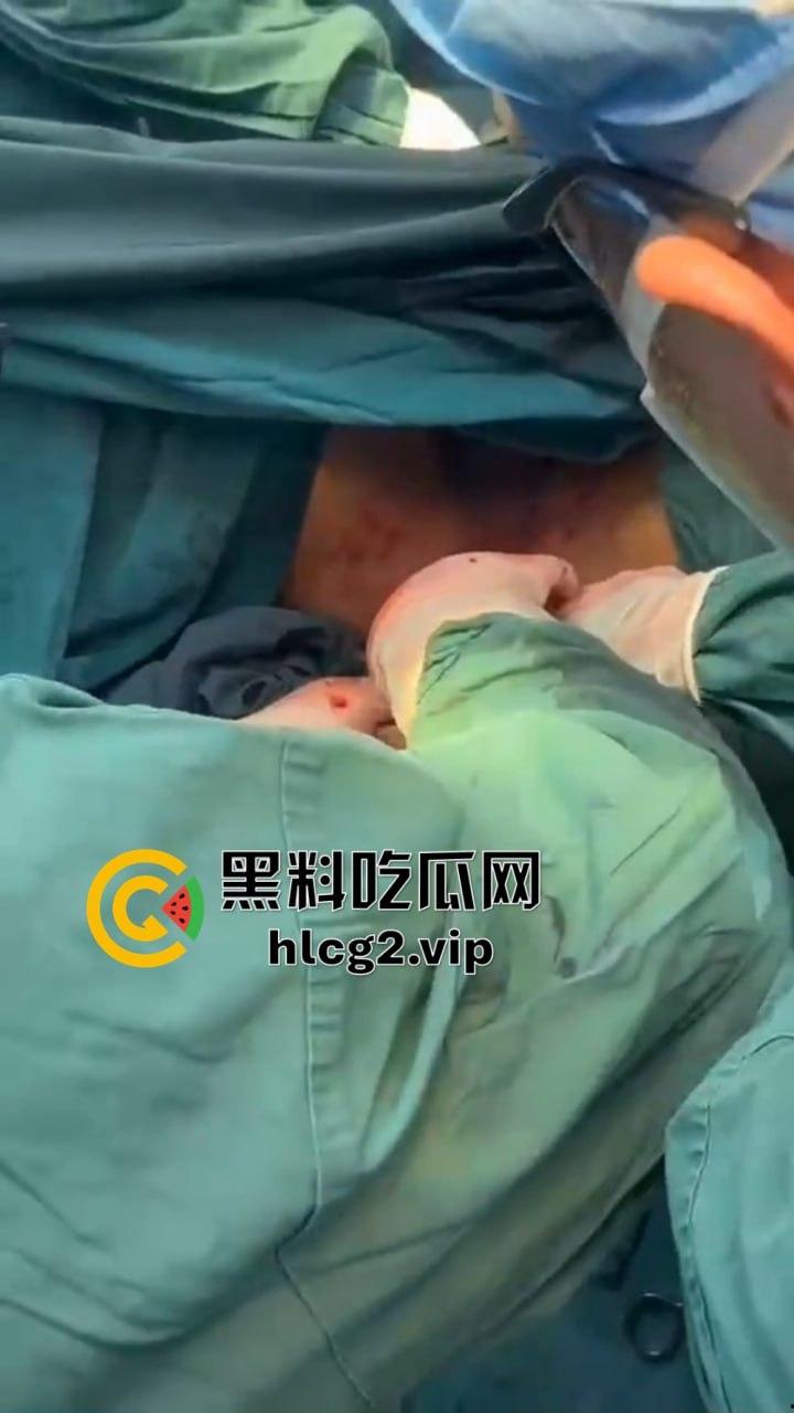 重口慎点！男子硬塞20厘米假体进体内，女子螃蟹夹逼狠整，为了流量太拼了！  第10张