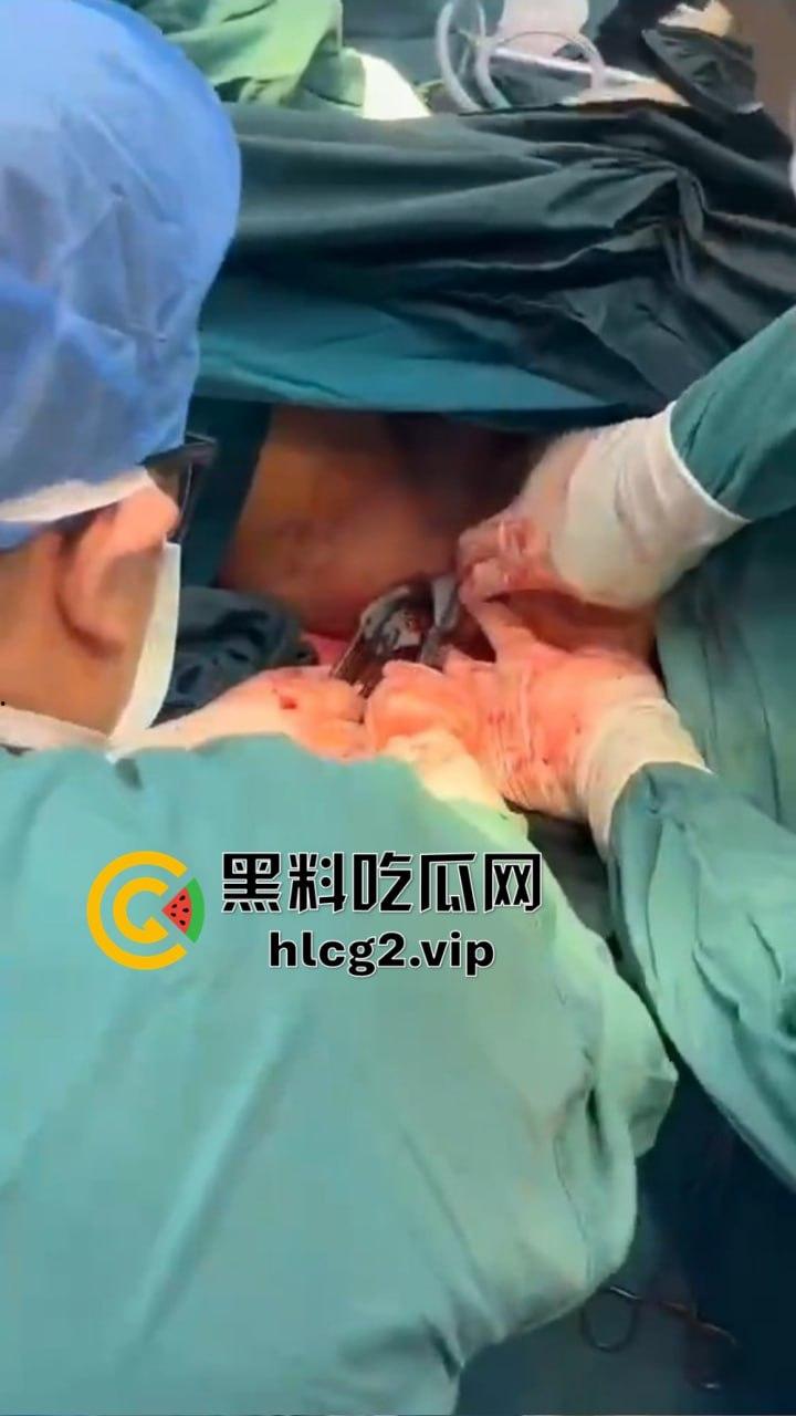 重口慎点！男子硬塞20厘米假体进体内，女子螃蟹夹逼狠整，为了流量太拼了！  第11张