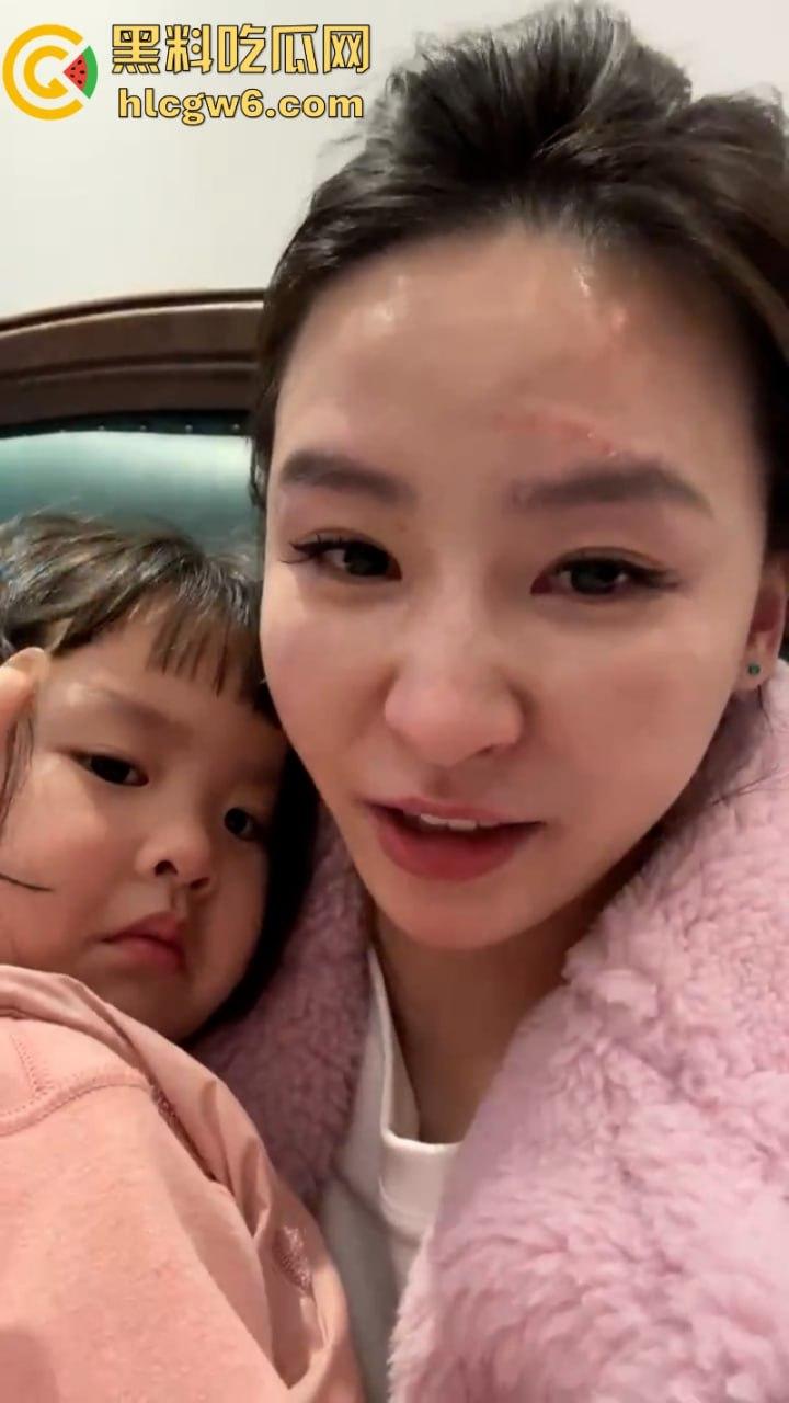 湖北一小学美女老师抖音自曝离婚探女遭前夫爹殴打抓脸全身多处受伤 伤情实拍曝光!都是血口子 第3张 湖北一小学美女老师抖音自曝离婚探女遭前夫爹殴打抓脸全身多处受伤 伤情实拍曝光!都是血口子 第3张