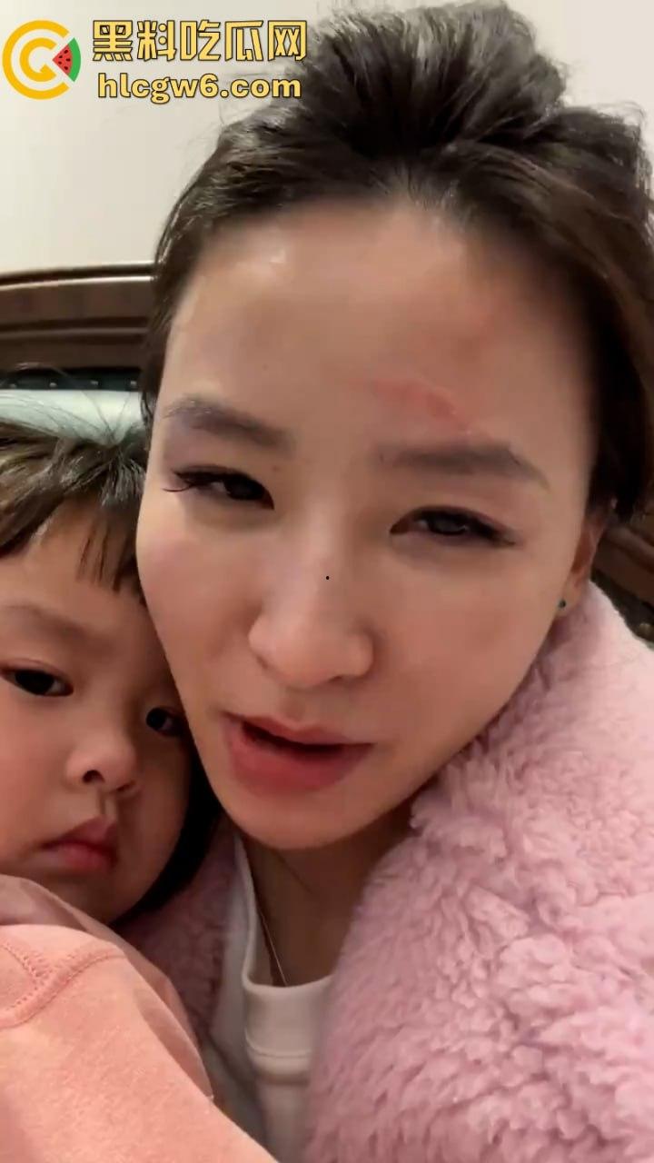 湖北一小学美女老师抖音自曝离婚探女遭前夫爹殴打抓脸全身多处受伤 伤情实拍曝光!都是血口子 第4张 湖北一小学美女老师抖音自曝离婚探女遭前夫爹殴打抓脸全身多处受伤 伤情实拍曝光!都是血口子 第4张