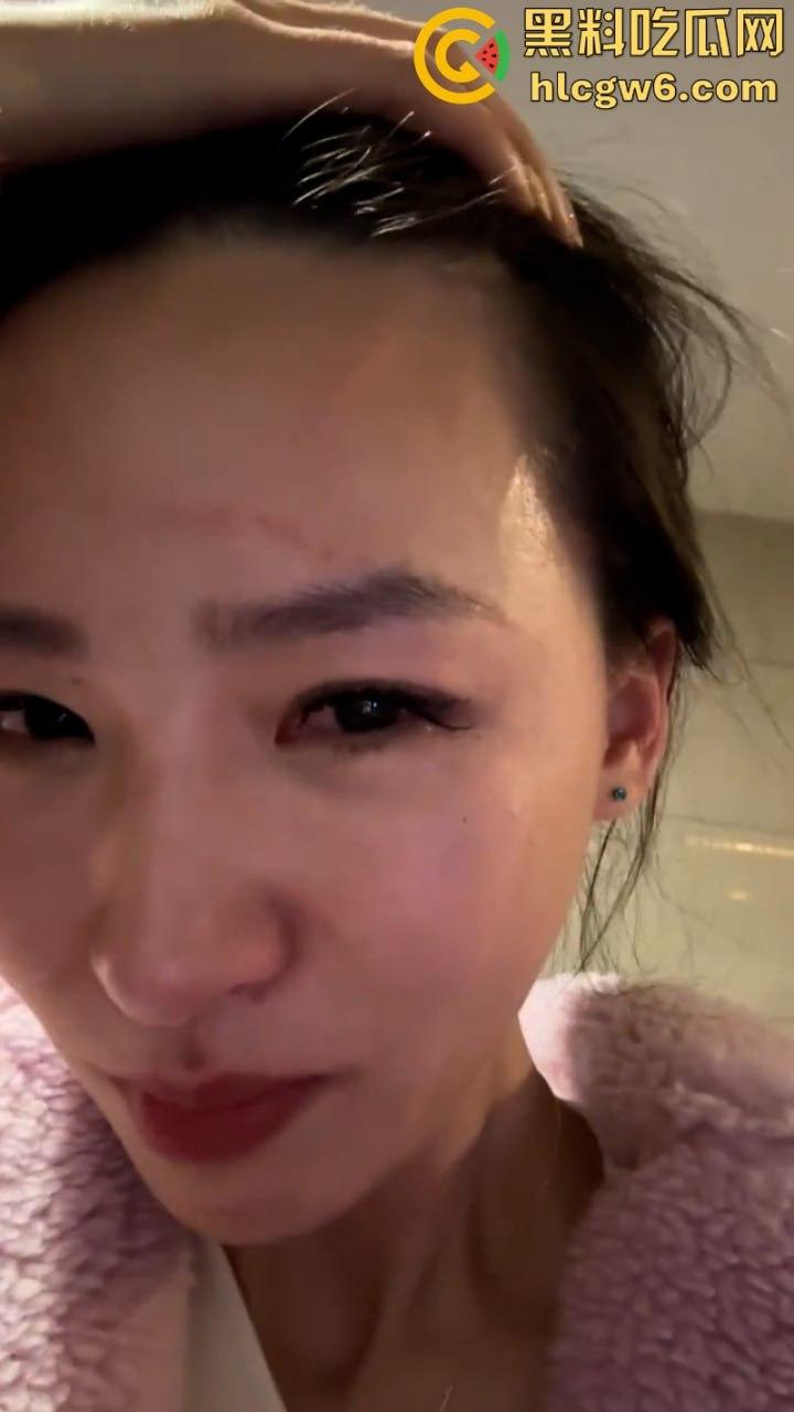 湖北一小学美女老师抖音自曝离婚探女遭前夫爹殴打抓脸全身多处受伤 伤情实拍曝光!都是血口子 第8张 湖北一小学美女老师抖音自曝离婚探女遭前夫爹殴打抓脸全身多处受伤 伤情实拍曝光!都是血口子 第8张