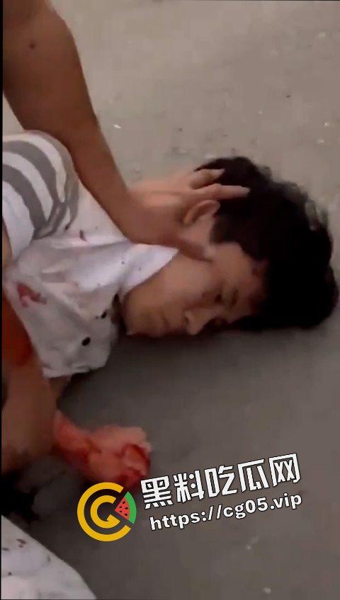 12.19日三亚南滨中学门口精神小伙为爱砍人！现场画面曝光 遍地鲜血 三名女子被砍伤 一人正在抢救中  第4张