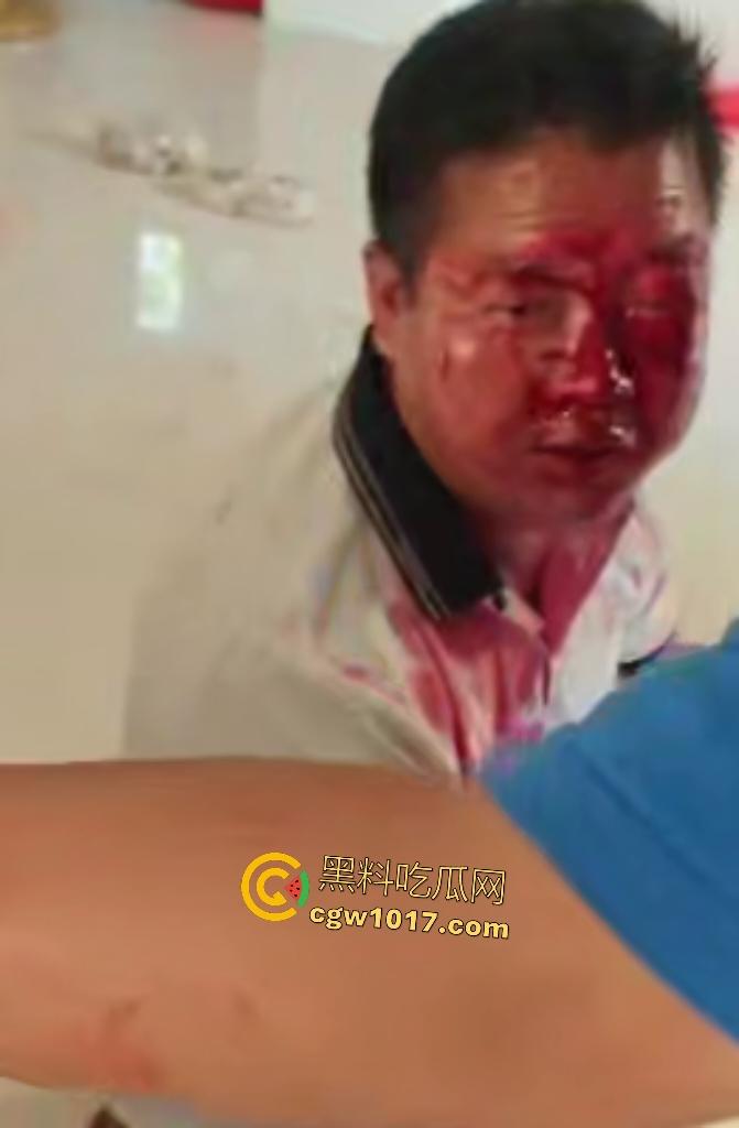 游戏团战关键时刻被老爸关电脑，网瘾儿子阿强直接打亲爸头破血流，老爸跪地求饶“我错了”，老妈哭求和解！  第5张