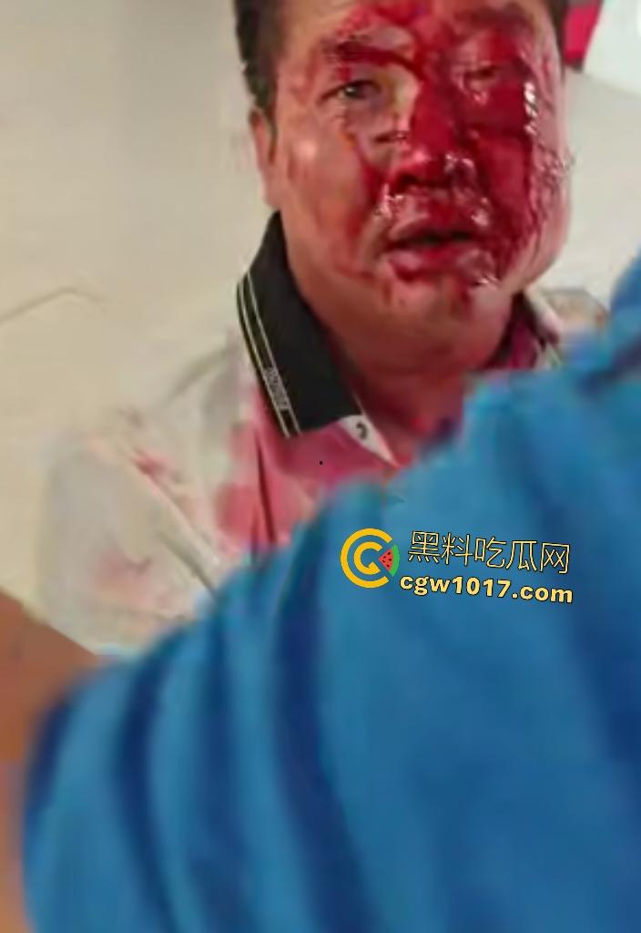 游戏团战关键时刻被老爸关电脑，网瘾儿子阿强直接打亲爸头破血流，老爸跪地求饶“我错了”，老妈哭求和解！  第6张