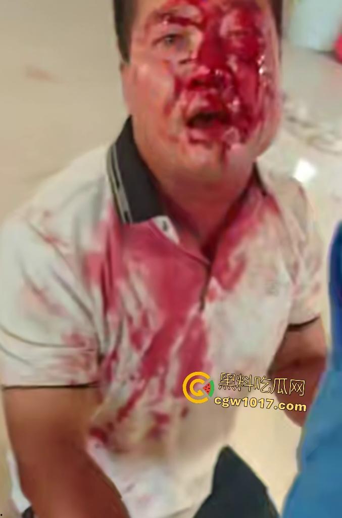 游戏团战关键时刻被老爸关电脑，网瘾儿子阿强直接打亲爸头破血流，老爸跪地求饶“我错了”，老妈哭求和解！  第7张