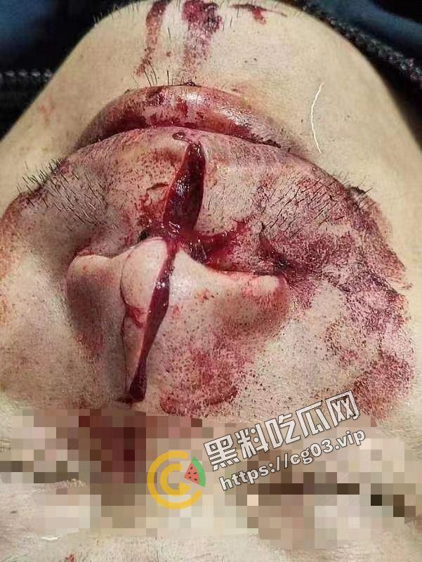 嚣张！广西容县城北路少年砍人 与警察互博 砍伤警察 拒不伏法 嚣张至极  第5张