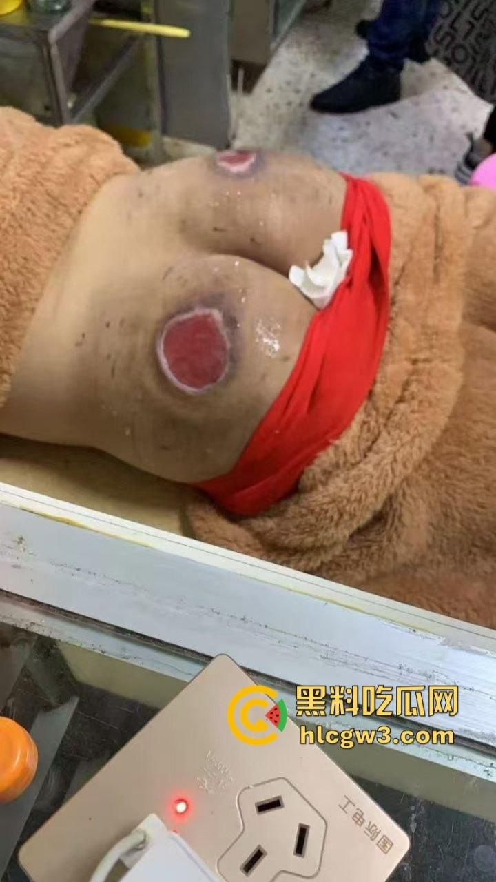 缅北电诈猪仔【陈锦和】失联4个月终获救 屁股惨遭电刑割肉伤疤惨不忍睹 真是炼狱一日游! 第8张 缅北电诈猪仔【陈锦和】失联4个月终获救 屁股惨遭电刑割肉伤疤惨不忍睹 真是炼狱一日游! 第8张