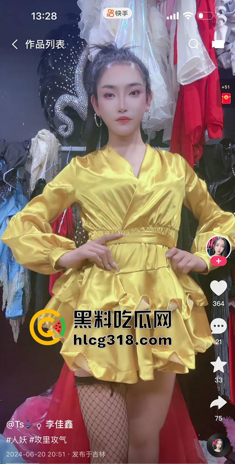 吉林顶级ts尤物【李佳鑫】,高颜值细腰长腿骚货,经常夜场演出穿着诱人,约炮大哥爆操菊花! 第3张 吉林顶级ts尤物【李佳鑫】,高颜值细腰长腿骚货,经常夜场演出穿着诱人,约炮大哥爆操菊花! 第3张