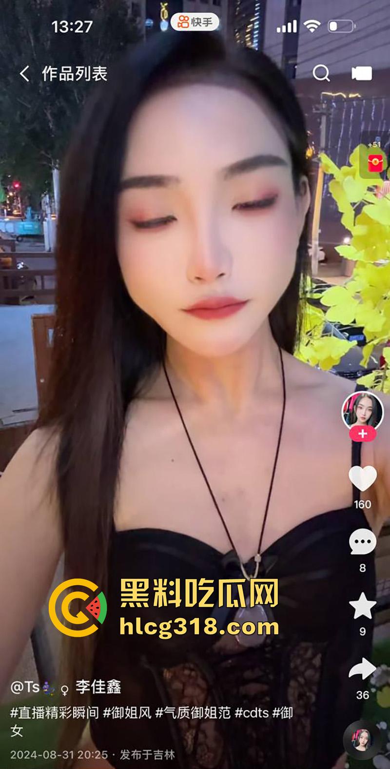 吉林顶级ts尤物【李佳鑫】,高颜值细腰长腿骚货,经常夜场演出穿着诱人,约炮大哥爆操菊花! 第4张 吉林顶级ts尤物【李佳鑫】,高颜值细腰长腿骚货,经常夜场演出穿着诱人,约炮大哥爆操菊花! 第4张