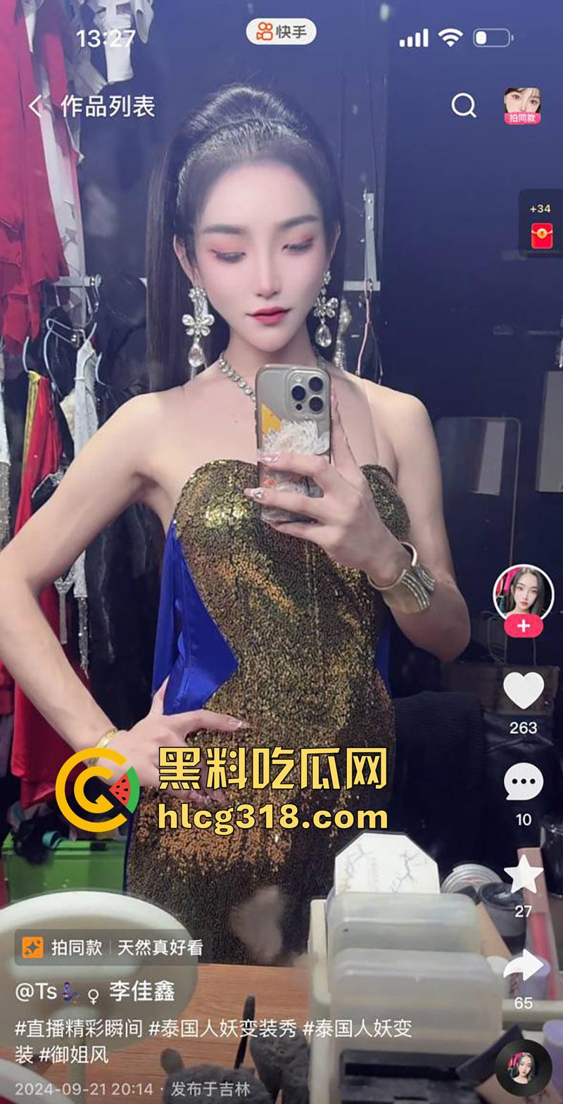 吉林顶级ts尤物【李佳鑫】,高颜值细腰长腿骚货,经常夜场演出穿着诱人,约炮大哥爆操菊花! 第6张 吉林顶级ts尤物【李佳鑫】,高颜值细腰长腿骚货,经常夜场演出穿着诱人,约炮大哥爆操菊花! 第6张