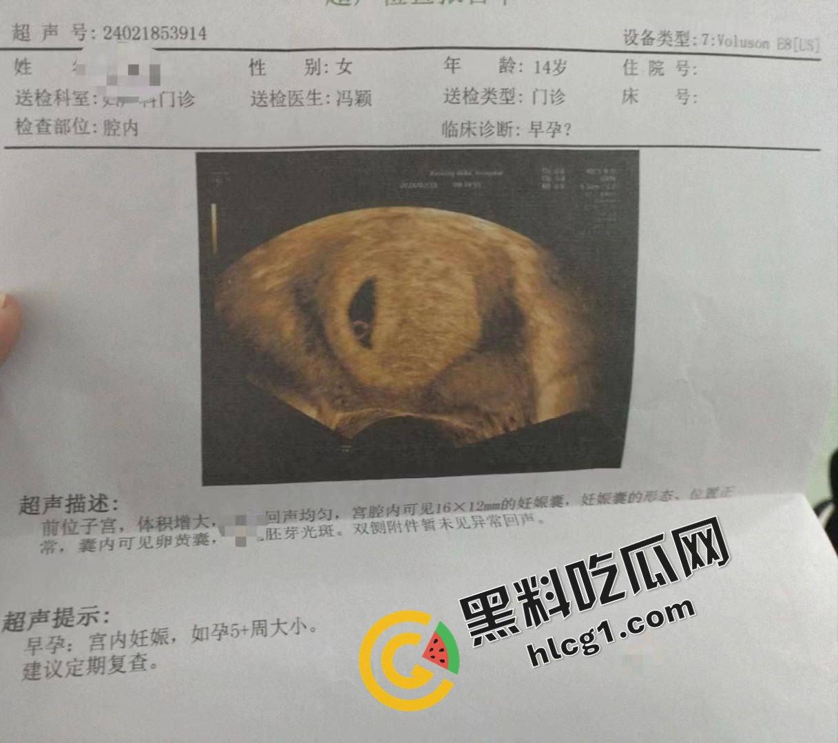 逆天事件！初中生14岁偷吃禁果 因为爽而不做措施无套内射 早孕发朋友圈炫耀  第4张