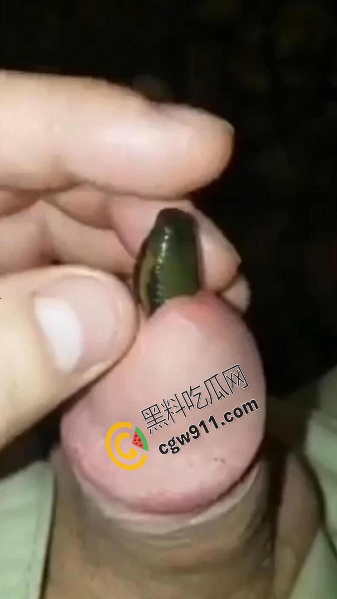 恐怖刺激!活蚂蟥钻入男子大屌的惊悚作死视频,观看者直呼恶心,视觉冲击骇人听闻 第4张 恐怖刺激!活蚂蟥钻入男子大屌的惊悚作死视频,观看者直呼恶心,视觉冲击骇人听闻 第4张