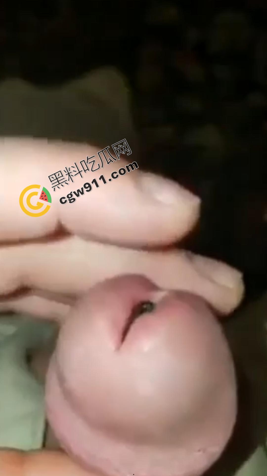 恐怖刺激!活蚂蟥钻入男子大屌的惊悚作死视频,观看者直呼恶心,视觉冲击骇人听闻 第5张 恐怖刺激!活蚂蟥钻入男子大屌的惊悚作死视频,观看者直呼恶心,视觉冲击骇人听闻 第5张