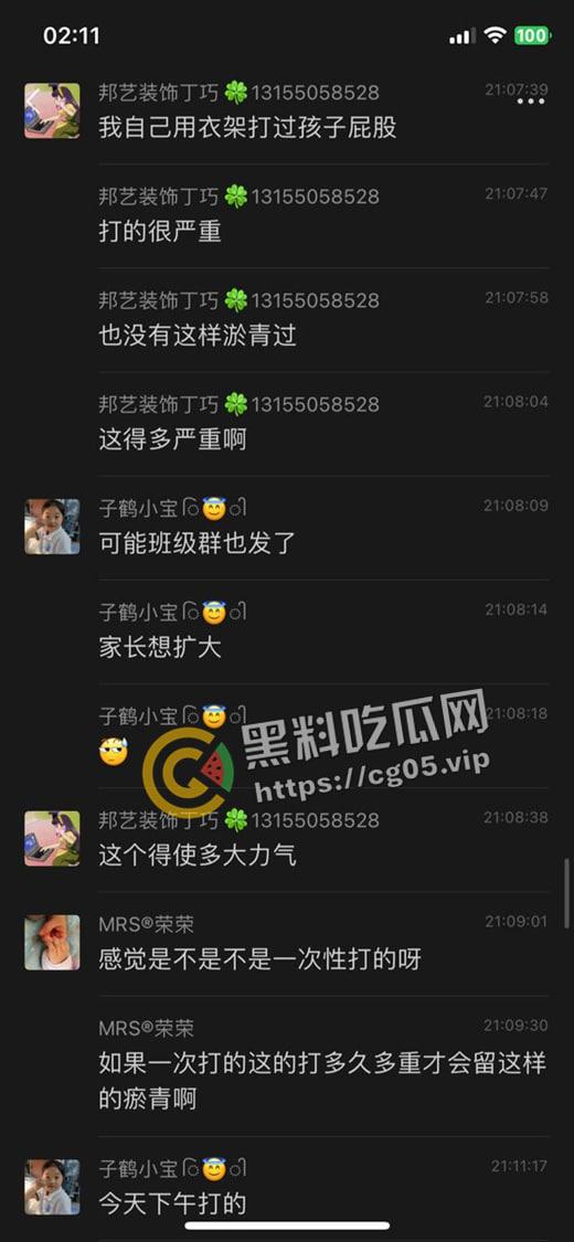 泰州外国语小学老师暴打小学生 全身淤青 家长群内声讨被解散 至今无说法 第6张 泰州外国语小学老师暴打小学生 全身淤青 家长群内声讨被解散 至今无说法 第6张